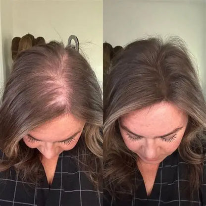 Lewedo™- Pure Batana Hair Oil